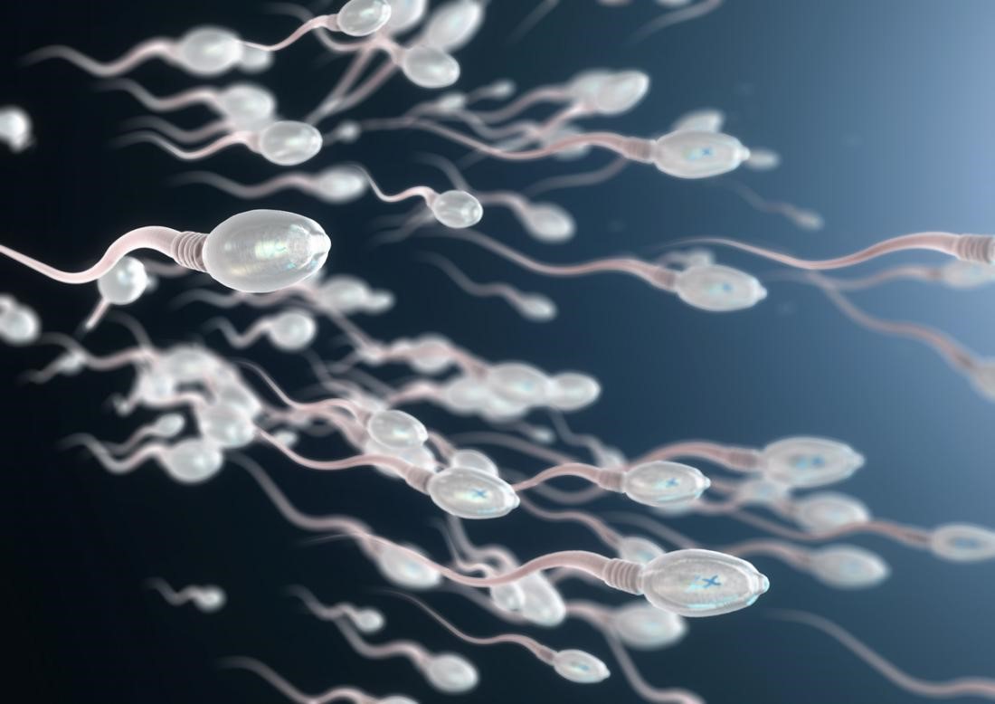 Male infertility cause